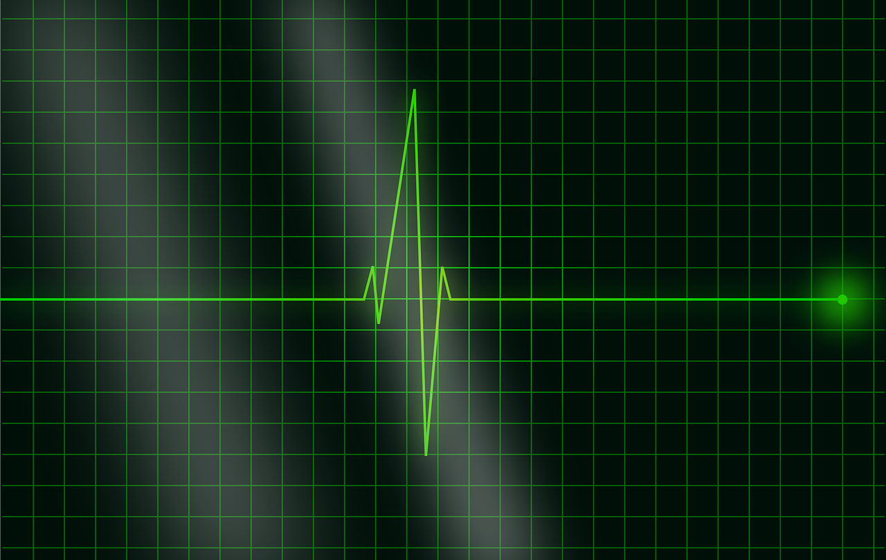 electrocardiogram-g97a64a9a4_1280