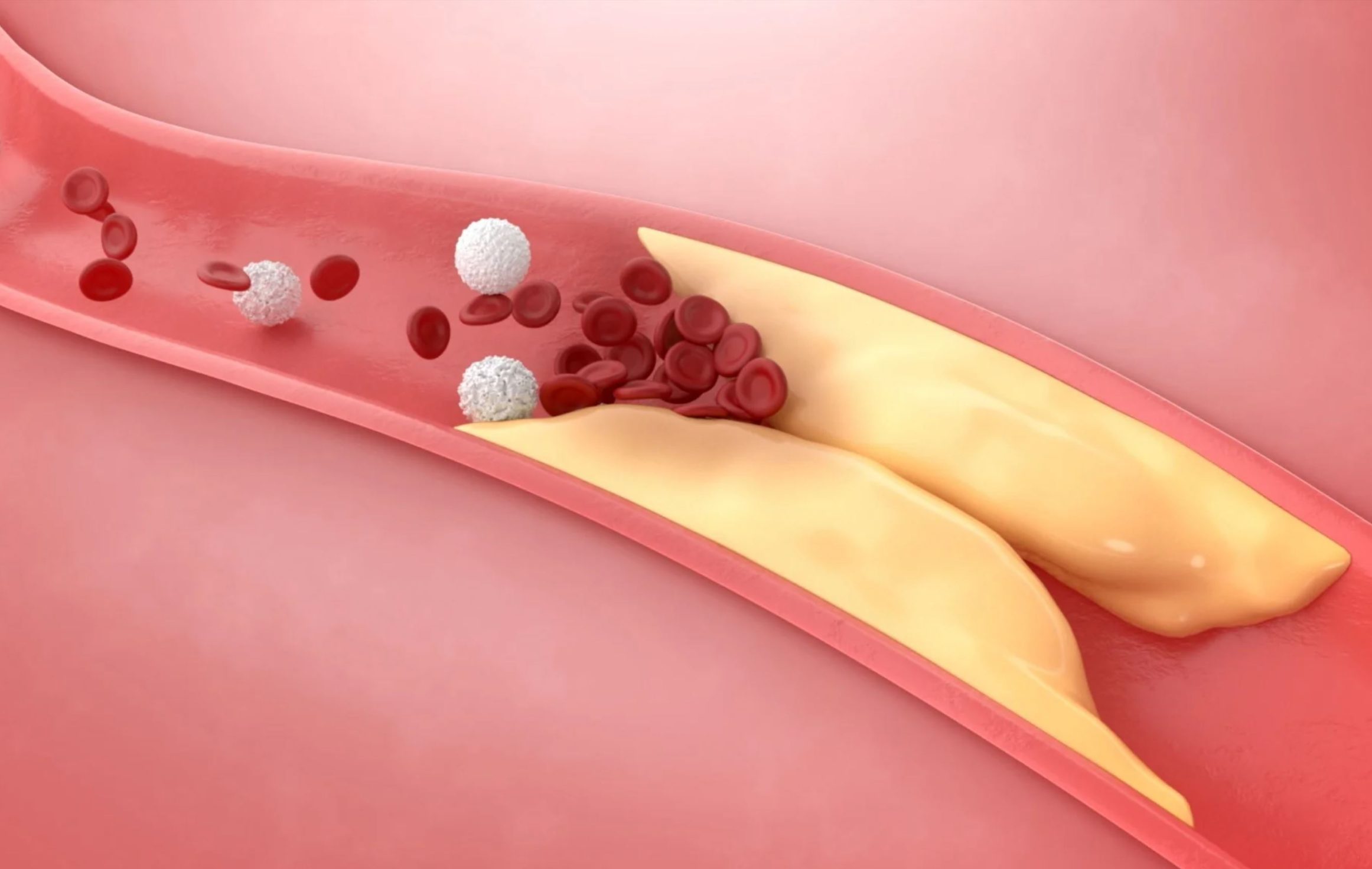 Cholesterol