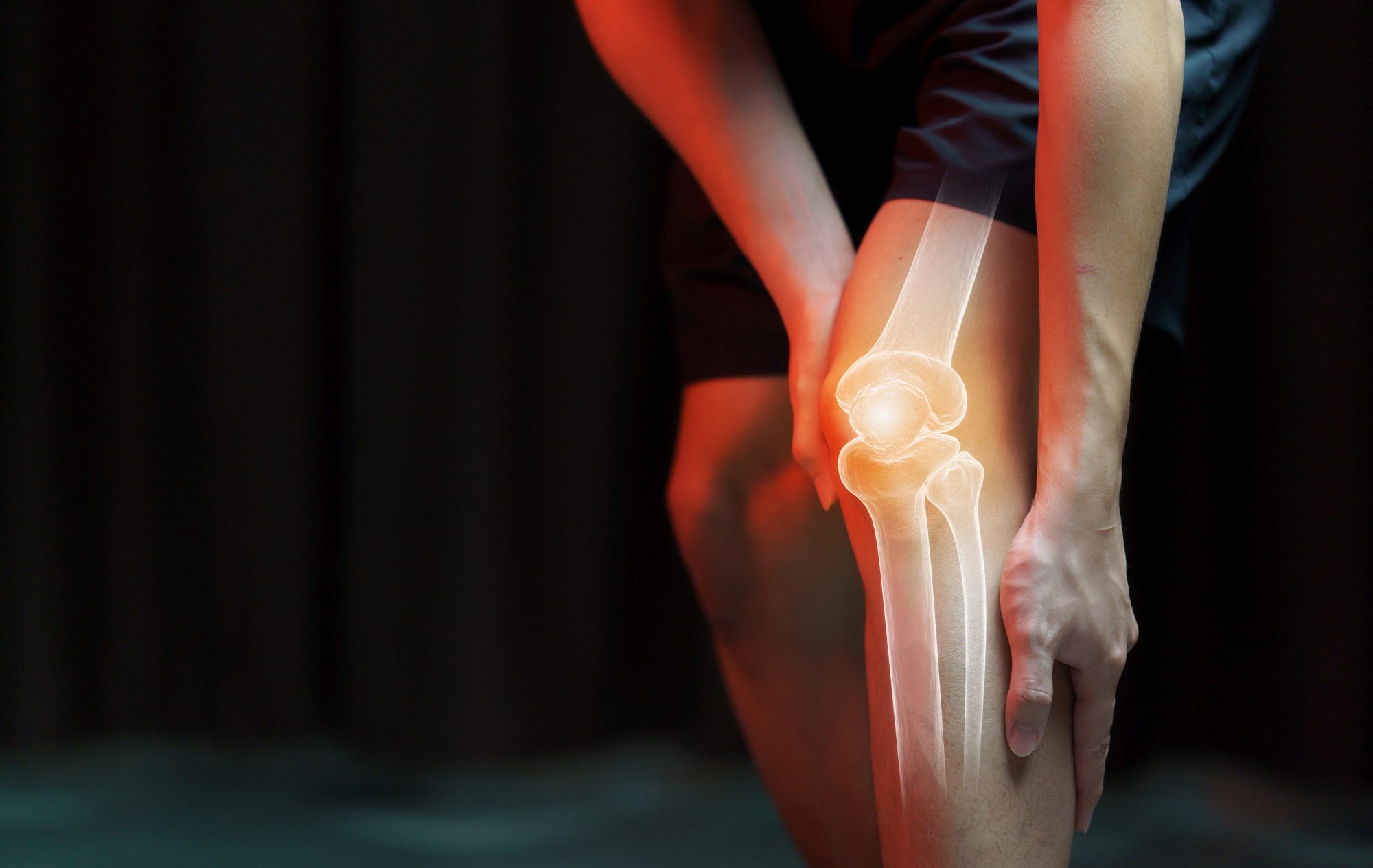 KNEE-FRACTURES